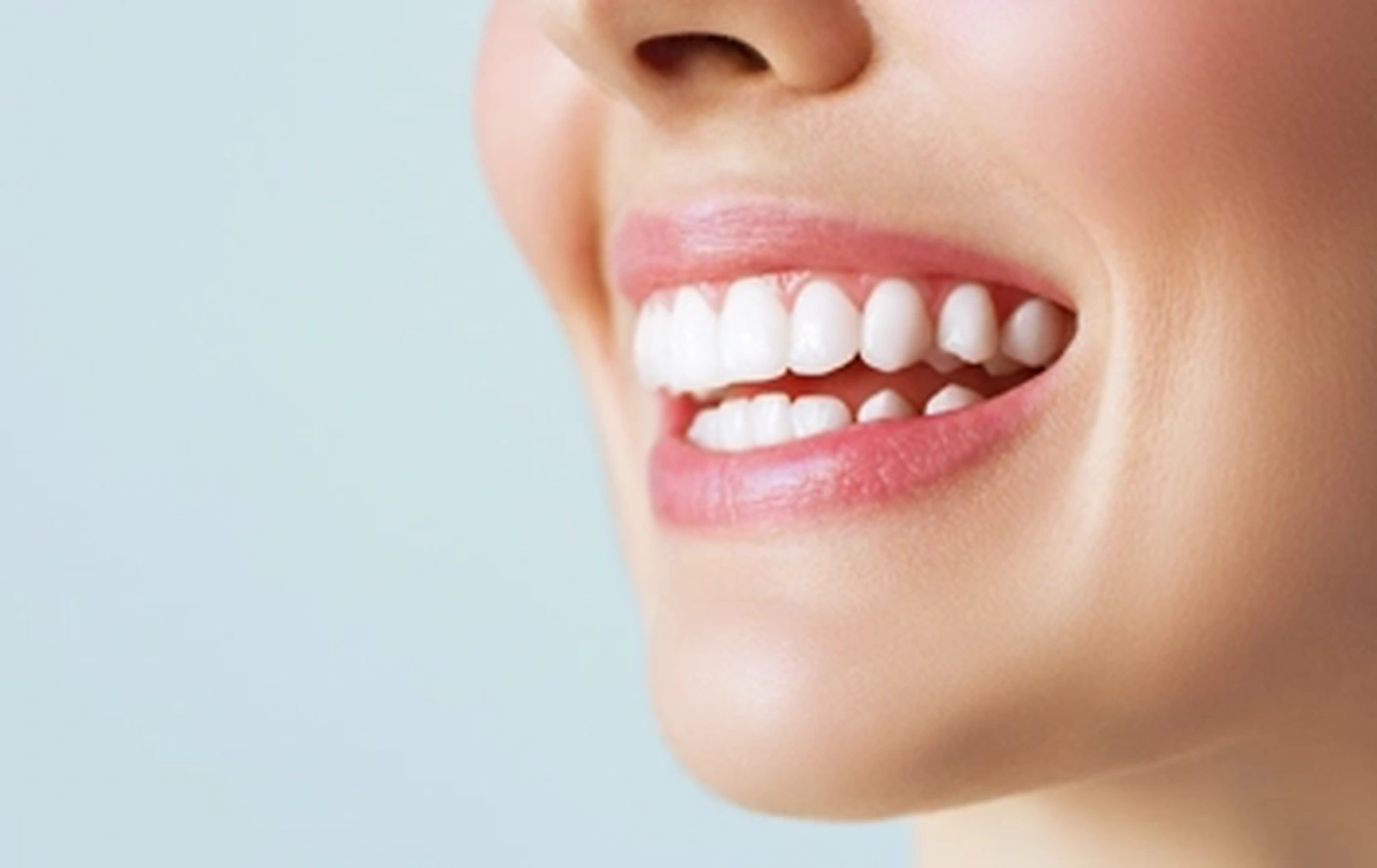 Sorriso após clareamento dental