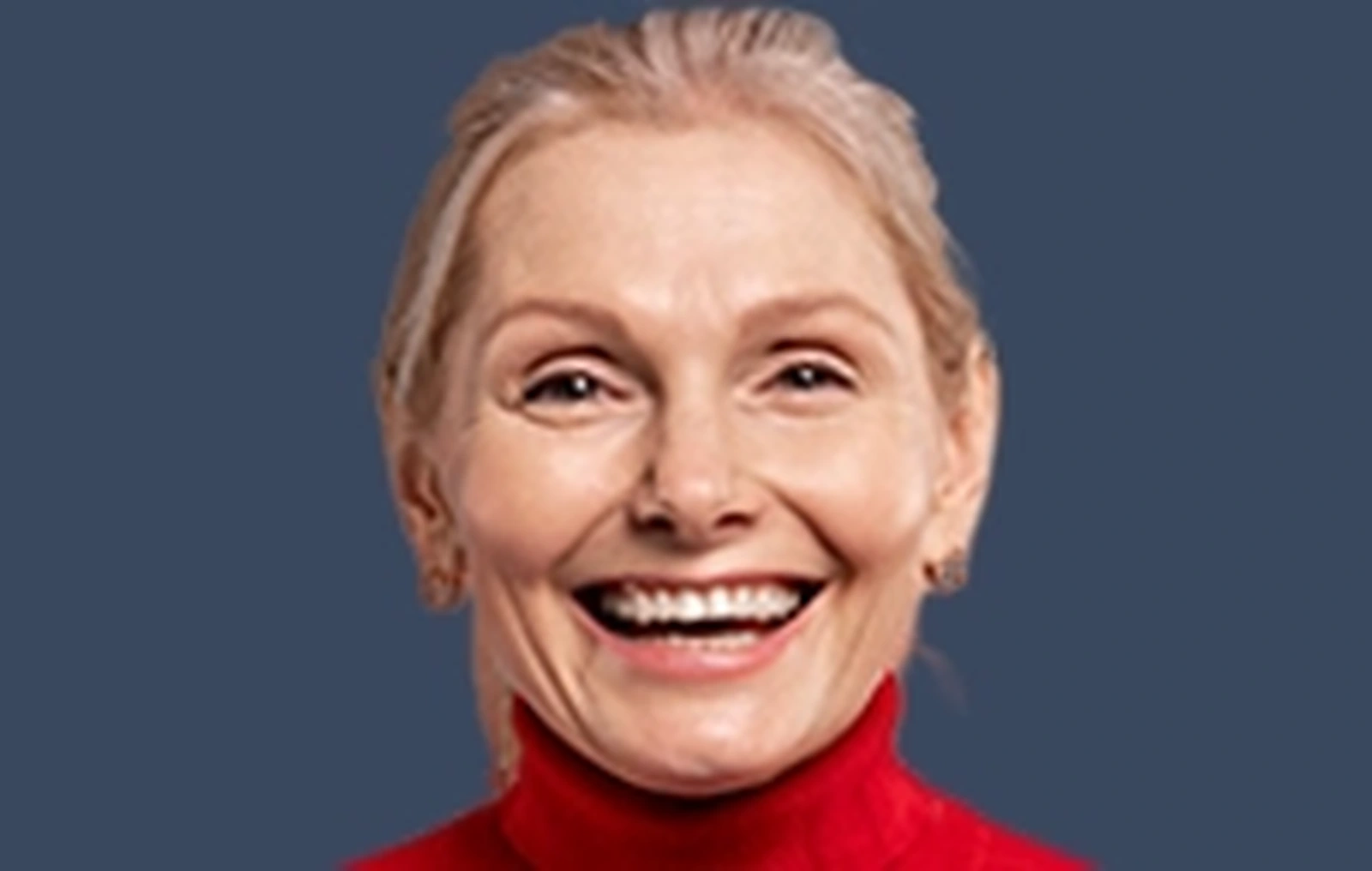Implante dentário